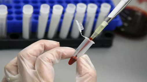 Người phụ nữ đầu tiên khỏi nhiễm HIV sau khi được ghép tế bào gốc
