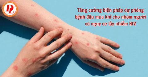 Tăng cường dự phòng đậu mùa khỉ cho nhóm đối tượng có hành vi nguy cơ lây nhiễm HIV