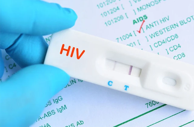 Hướng dẫn nhận miễn phí Bộ Kit tự xét nghiệm HIV tại nhà