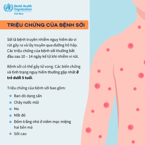 Truyền thông phòng chống bệnh Sởi (WHO)