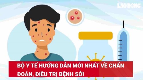 Bộ Y tế hướng dẫn mới nhất chẩn đoán, điều trị bệnh sởi