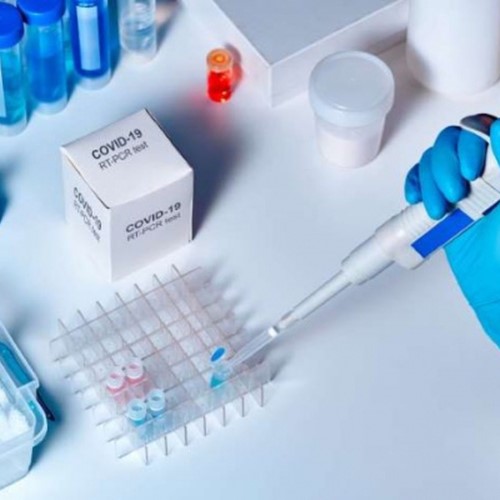 Ý nghĩa con số CT của xét nghiệm RT-PCR COVID-19
