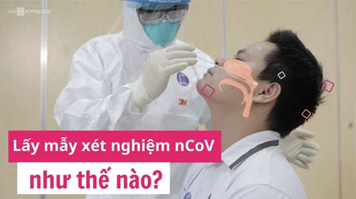 [VIDEO]: Hướng dẫn chọt mũi lấy mẫu test nhanh COVID-19 chính xác nhất