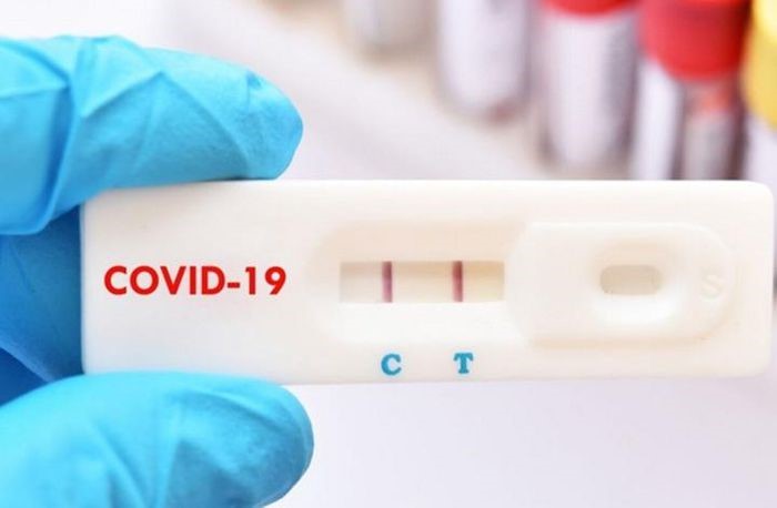 Test nhanh Covid-19, người 3 ngày âm tính, người 15 ngày vẫn dương tính?