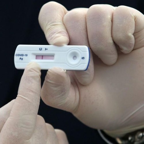 Tiếp xúc F0 sau bao lâu cần test nhanh Covid-19?