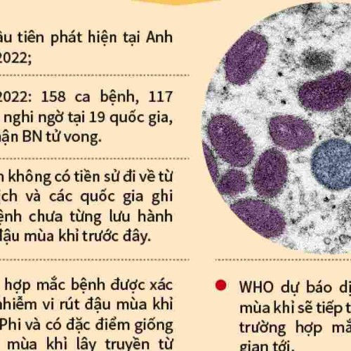 Bệnh đậu mùa khỉ – những điều cần biết – cách phòng bệnh