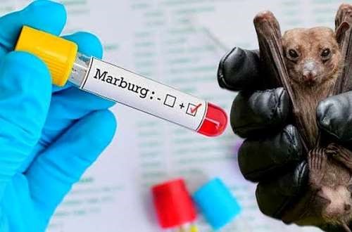 Virus Marburg triệu chứng là gì và cách phòng tránh lây nhiễm
