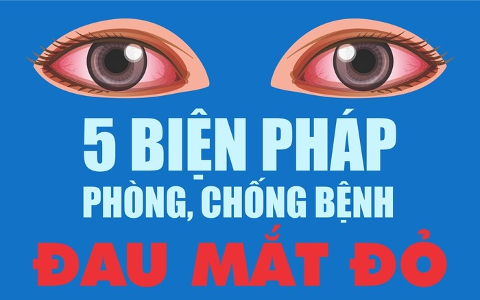 [Infographic] – 5 biện pháp phòng chống Đau mắt đỏ