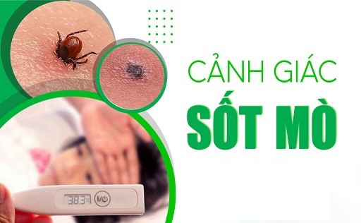 Bệnh sốt mò