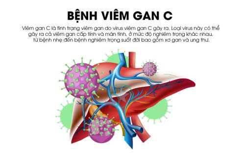 Phác đồ điều trị bệnh Viêm gan vi rút C