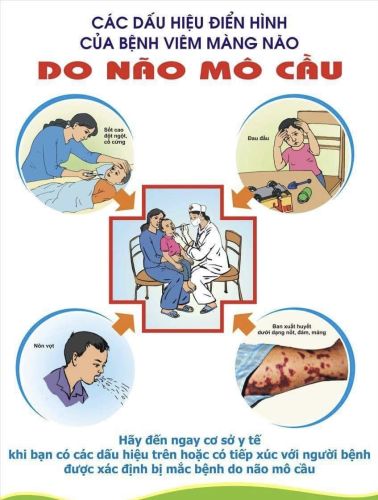 Các dấu hiệu điển hình của bệnh viêm màng não do não mô cầu
