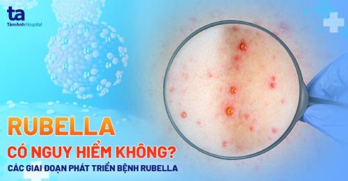 BỆNH RUBELLA