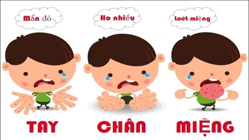 BỆNH TAY - CHÂN - MIỆNG